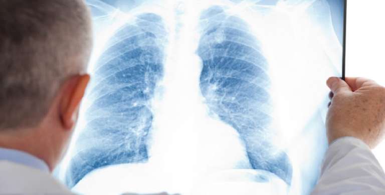 PUGLIA: ESAMI RADIOLOGICI A DOMICILIO, APPROVATA LA PROPOSTA DI LEGGE