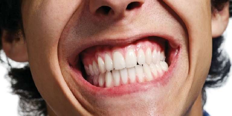 SAN NICANDRO: “I PARENT’ SO’ COM’ I DENT’, CCHIU’ SO STRITT’ E CCHIU’ FAN MAL”