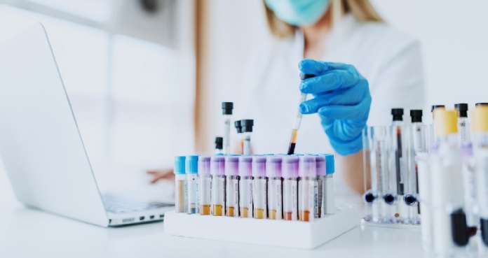 Close up of lab assistant in uniform, with mask and rubber gloves holding test tube with blood sample while sitting on chair and typing on laptop. Selective focus on test tubes.