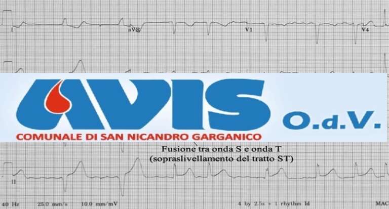 AVIS SAN NICANDRO, DONAZIONE ED ELETROCARDIOGRAMMA